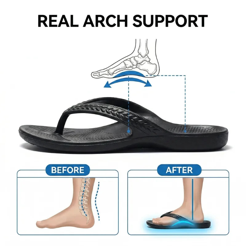 Cloud Flip - Arch Support Flip Flops for Pain-Free Walking
